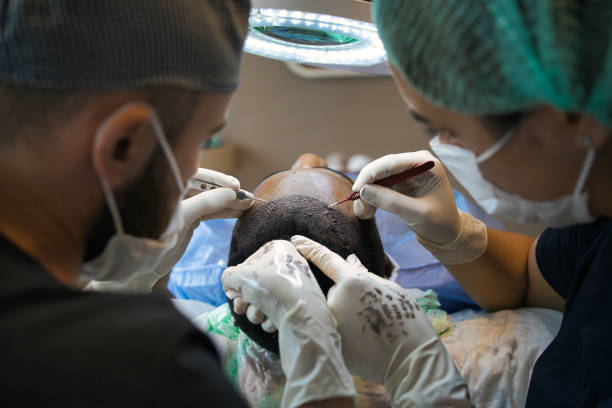 Les progrès médicaux ont changé la manière de faire les greffes. En effet, les chirurgiens utilisent aujourd’hui des outils très précis.